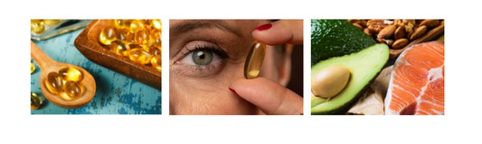 Why Omega-3s and Dry Eye are Related