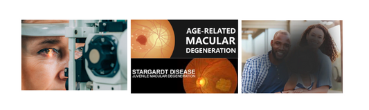 Macular degeneration image of the eye and what is their vision like 